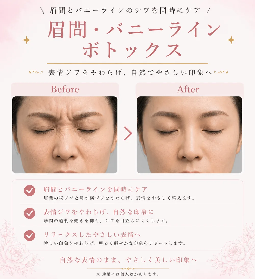 ボツリヌストキシン注射の症例写真(眉間・バニーラインのしわ)|ヒロクリニック美容皮膚科