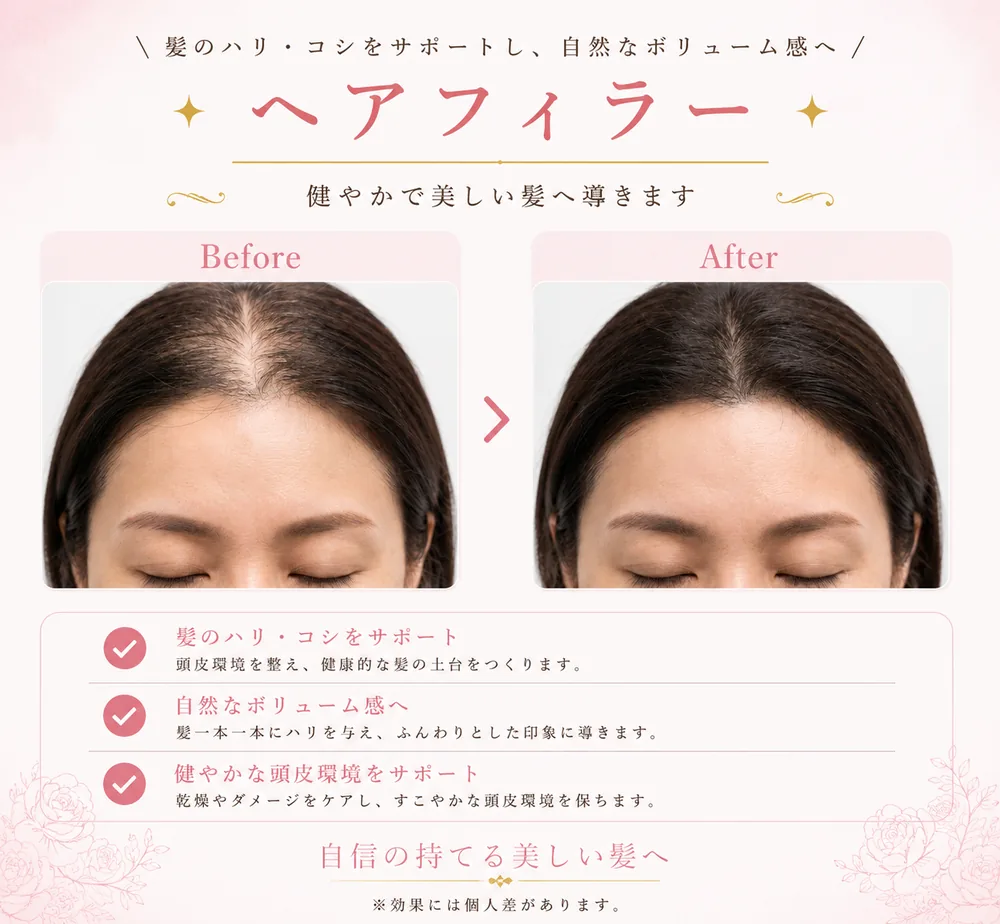 Dr.CYJ ヘアフィラーの症例写真(髪のハリ・ボリューム)|ヒロクリニック美容皮膚科