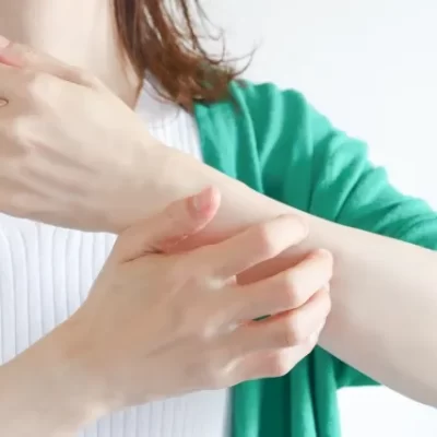 肌トラブル 女性