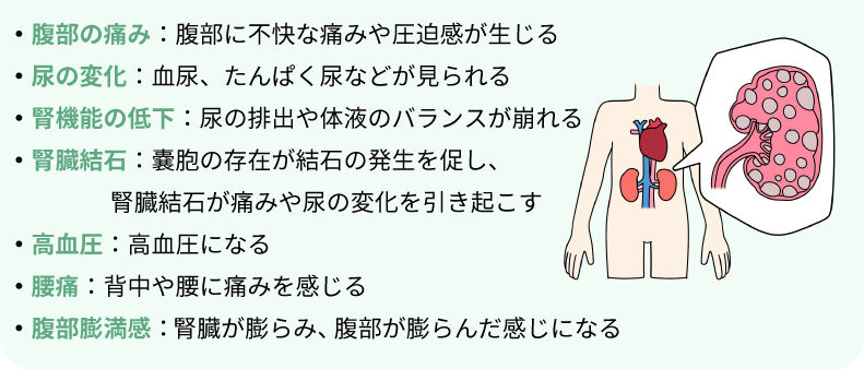 多発性嚢胞腎疾患