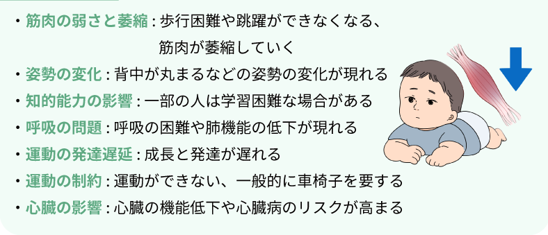 デュシェンヌ型筋ジストロフィーX連鎖性