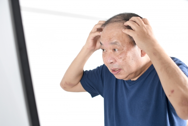 50代男性が鏡の前で、自身の進行する薄毛と肌の老化に驚きと落胆の表情を浮かべている。これは加齢のせいなのか?以前のように改善できる方法はあるのか――そんな疑問を抱く瞬間を捉えた一枚。