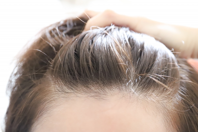 手が髪を頭頂部に持ち上げ、なめらかな肌の可愛らしいおでこがあらわに。スキンケアは美しいヘアケアの一部。保湿と水分ケアをしっかり続けてきたことがうかがえる、健やかな印象。