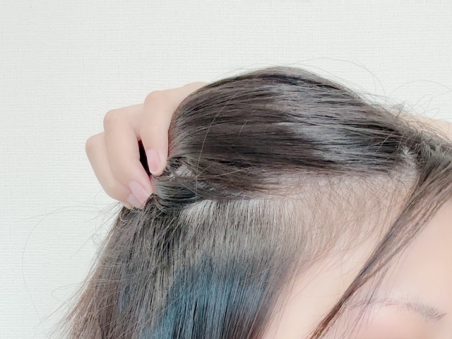髪の上層を束ねて持ち上げると、下の地肌近くの髪の薄さがあらわに。ヘアアレンジだけでは隠しきれない悩みが浮き彫りに。そろそろ専門クリニックでの薄毛治療や毛髪再生を検討する時期かもしれない。