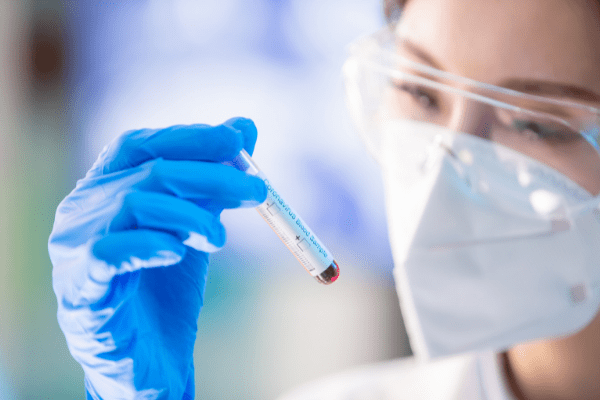 NIPT(新型出生前診断)検査結果の見方と注意点