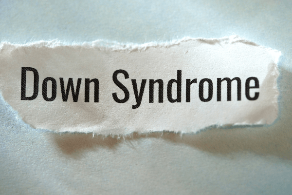 ダウン症(21トリソミー)とは