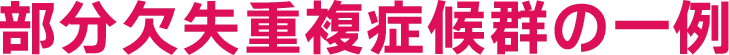 部分欠失重複症候群の一例
